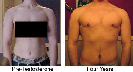 pre-t vs. 48 months torso comparison